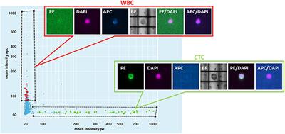 Genetic Characterization of Cancer of Unknown Primary Using Liquid Biopsy Approaches